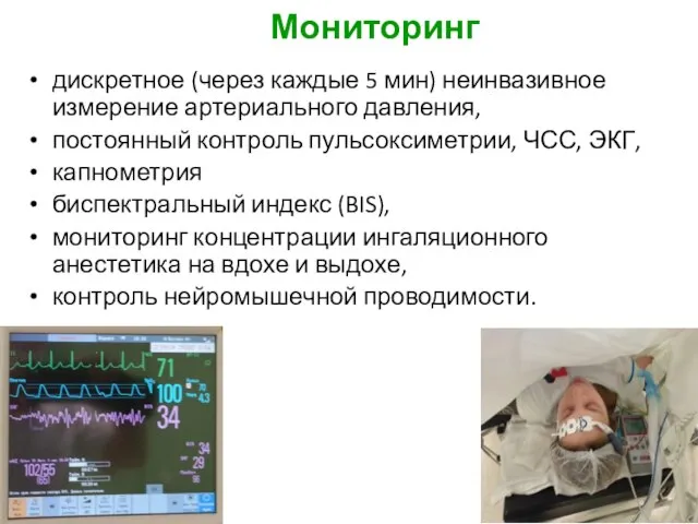 Мониторинг дискретное (через каждые 5 мин) неинвазивное измерение артериального давления, постоянный