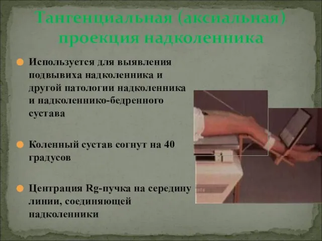 Используется для выявления подвывиха надколенника и другой патологии надколенника и надколеннико-бедренного