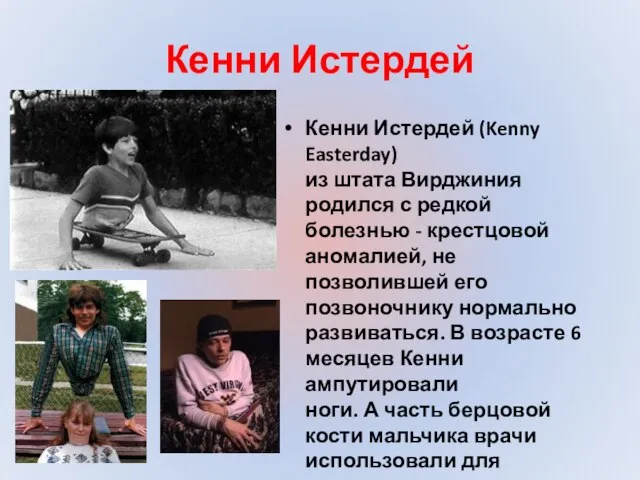 Кенни Истердей Кенни Истердей (Kenny Easterday) из штата Вирджиния родился с