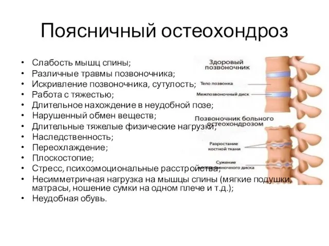 Поясничный остеохондроз Слабость мышц спины; Различные травмы позвоночника; Искривление позвоночника, сутулость;