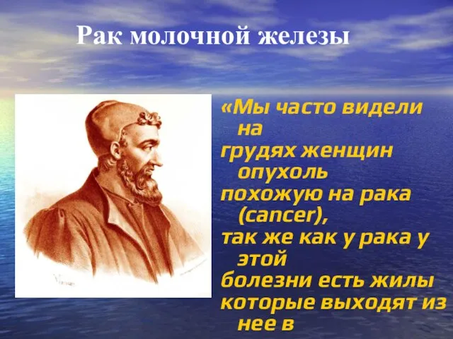 Рак молочной железы «Мы часто видели на грудях женщин опухоль похожую