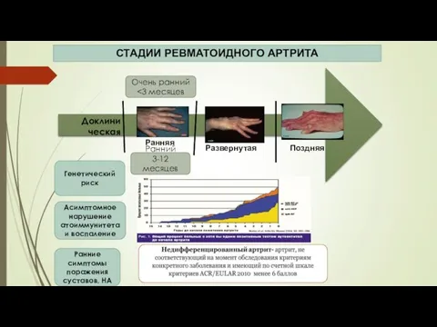 СТАДИИ РЕВМАТОИДНОГО АРТРИТА Ранняя Развернутая Поздняя Доклини ческая Очень ранний Генетический