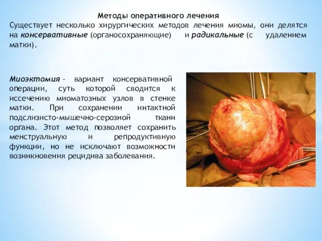 Методы оперативного лечения Существует несколько хирургических методов лечения миомы, они делятся