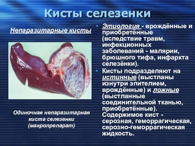 Кисты селезенки Этиология - врождённые и приобретённые (вследствие травм, инфекционных заболеваний