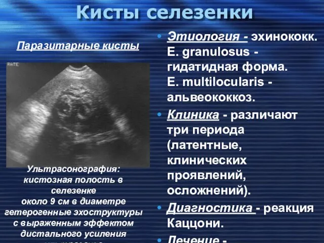 Кисты селезенки Этиология - эхинококк. E. granulosus - гидатидная форма. E.