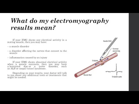 What do my electromyography results mean? If your EMG shows any