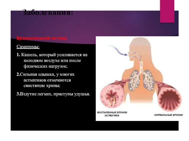 Заболевания: Бронхиальная астма Симптомы: 1. Кашель, который усиливается на холодном воздухе