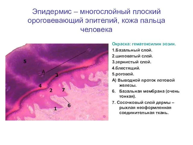 Эпидермис – многослойный плоский ороговевающий эпителий, кожа пальца человека Окраска: гематоксилин