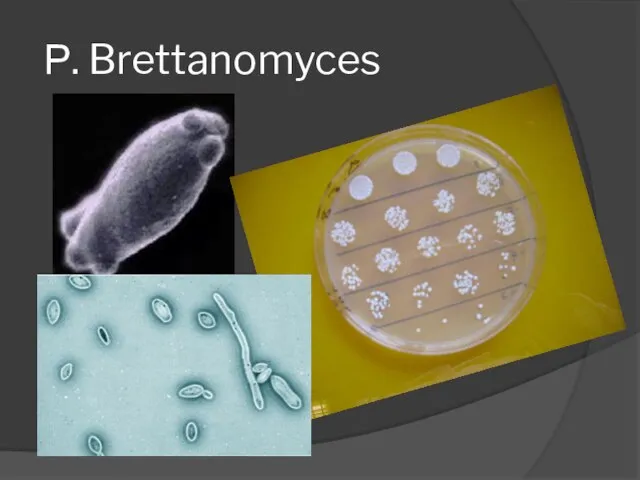 Р. Brettanomyces