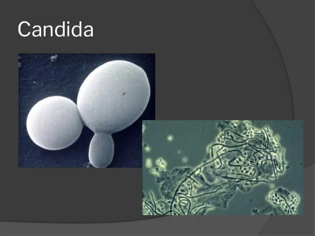 Candida