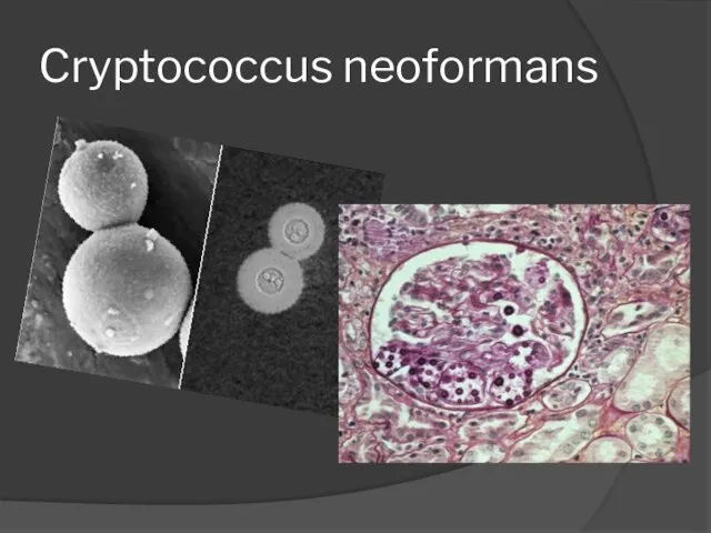 Cryptococcus neoformans