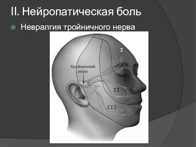 II. Нейропатическая боль Невралгия тройничного нерва