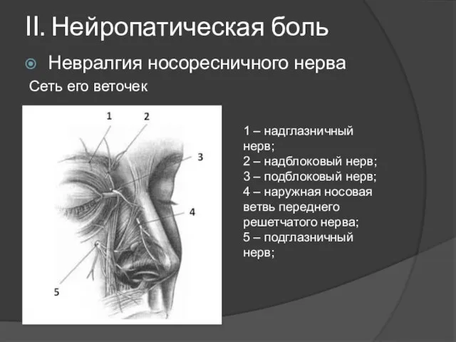 II. Нейропатическая боль Невралгия носоресничного нерва Сеть его веточек 1 –