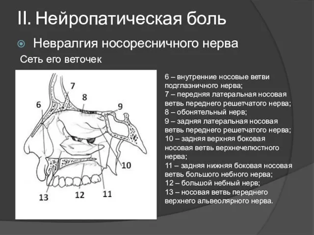 II. Нейропатическая боль Невралгия носоресничного нерва Сеть его веточек 6 –