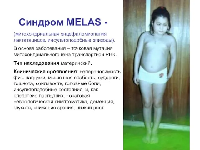 Синдром MELAS - (митохондриальная энцефаломиопатия, лактатацидоз, инсультоподобные эпизоды). В основе заболевания