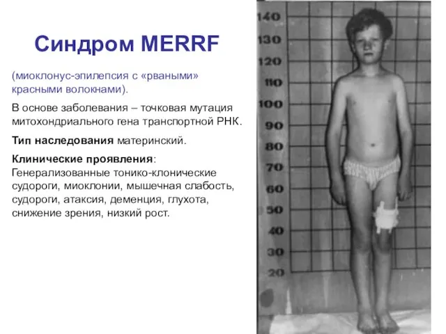 Синдром MERRF (миоклонус-эпилепсия с «рваными» красными волокнами). В основе заболевания –