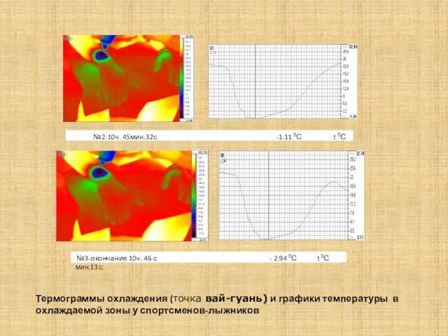 Термограммы охлаждения (точка вай-гуань) и графики температуры в охлаждаемой зоны у спортсменов-лыжников