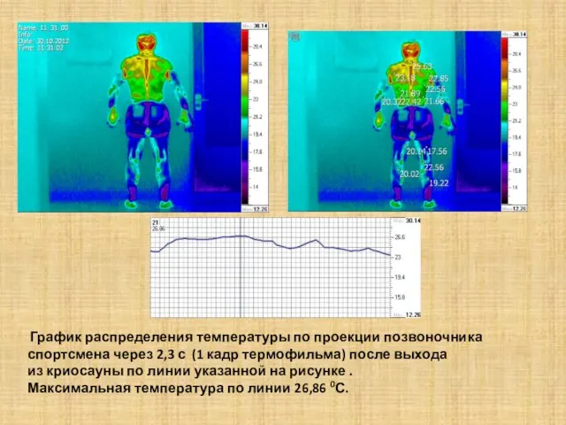 График распределения температуры по проекции позвоночника спортсмена через 2,3 с (1