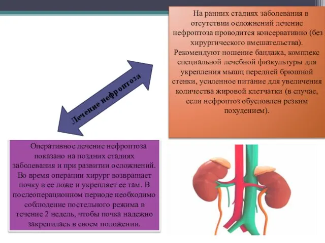 На ранних стадиях заболевания в отсутствии осложнений лечение нефроптоза проводится консервативно