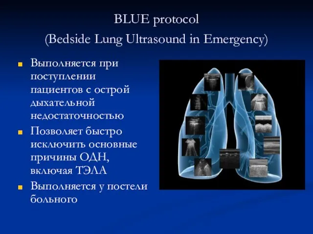 BLUE protocol (Bedside Lung Ultrasound in Emergency) Выполняется при поступлении пациентов
