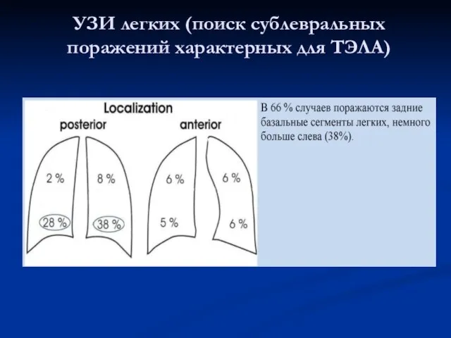 УЗИ легких (поиск сублевральных поражений характерных для ТЭЛА)