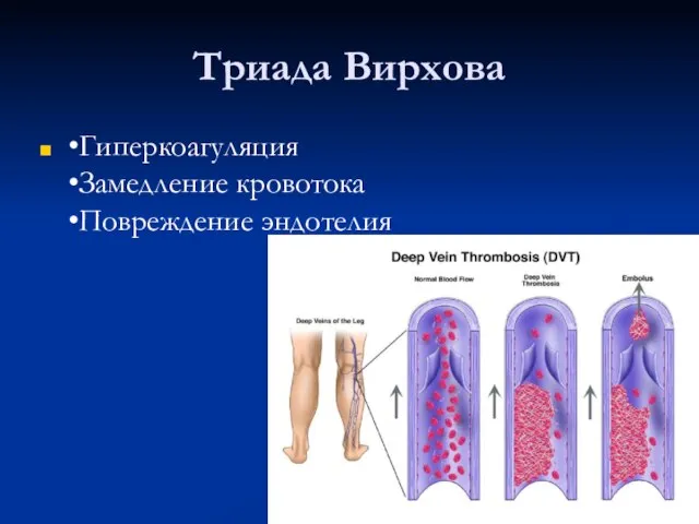 Триада Вирхова •Гиперкоагуляция •Замедление кровотока •Повреждение эндотелия