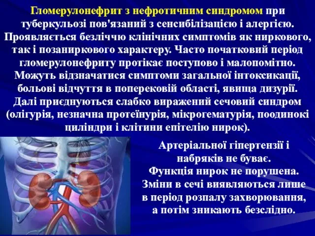 Гломерулонефрит з нефротичним синдромом при туберкульозі пов'язаний з сенсибілізацією і алергією.