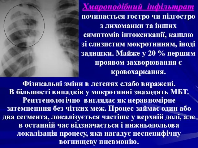 Фізикальні зміни в легенях слабо виражені. В більшості випадків у мокротинні