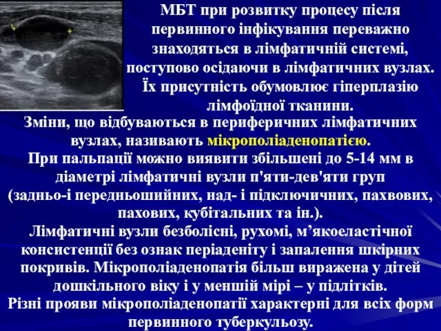 МБТ при розвитку процесу після первинного інфікування переважно знаходяться в лімфатичній