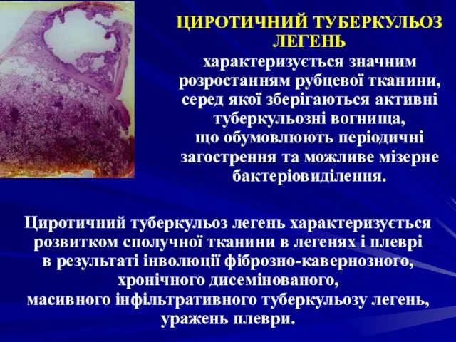 ЦИРОТИЧНИЙ ТУБЕРКУЛЬОЗ ЛЕГЕНЬ характеризується значним розростанням рубцевої тканини, серед якої зберігаються