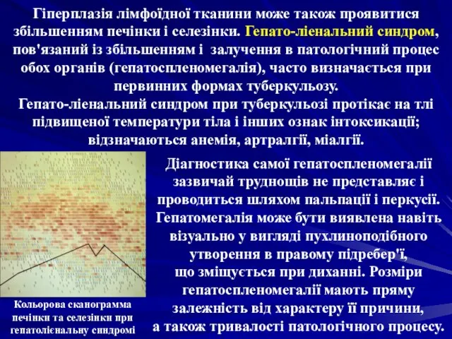 Гіперплазія лімфоїдної тканини може також проявитися збільшенням печінки і селезінки. Гепато-ліенальний