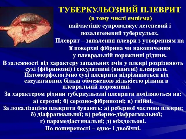 ТУБЕРКУЛЬОЗНИЙ ПЛЕВРИТ (в тому числі емпієма) найчастіше супроводжує легеневий і позалегеневий