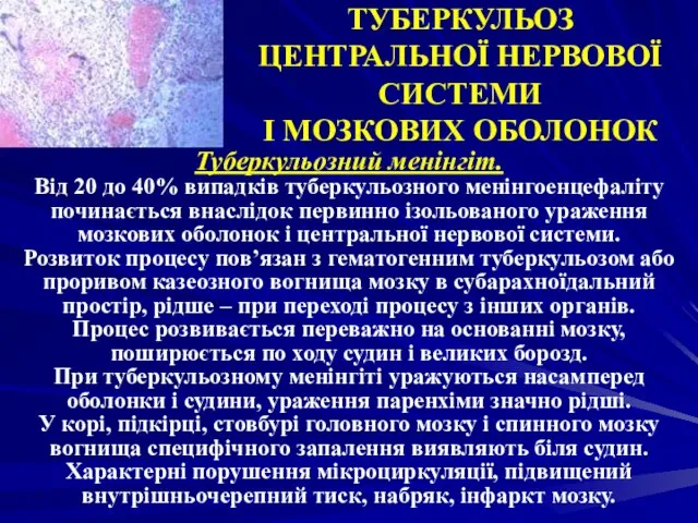 ТУБЕРКУЛЬОЗ ЦЕНТРАЛЬНОЇ НЕРВОВОЇ СИСТЕМИ І МОЗКОВИХ ОБОЛОНОК Туберкульозний менінгіт. Від 20