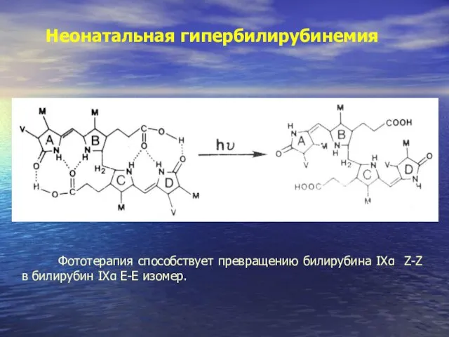 Неонатальная гипербилирубинемия Фототерапия способствует превращению билирубина IXα Z-Z в билирубин IXα Е-Е изомер.