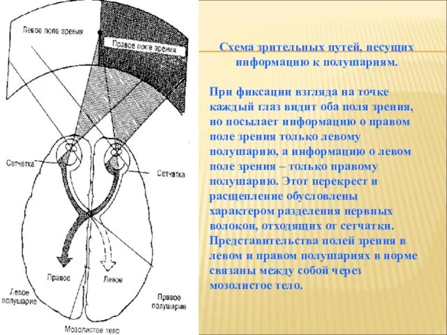 Схема зрительных путей, несущих информацию к полушариям. При фиксации взгляда на