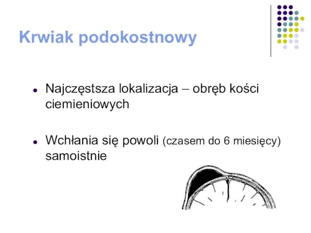 Krwiak podokostnowy Najczęstsza lokalizacja – obręb kości ciemieniowych Wchłania się powoli (czasem do 6 miesięcy) samoistnie