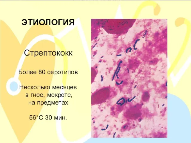 ЭТИОЛОГИЯ Стрептококк Более 80 серотипов Несколько месяцев в гное, мокроте, на