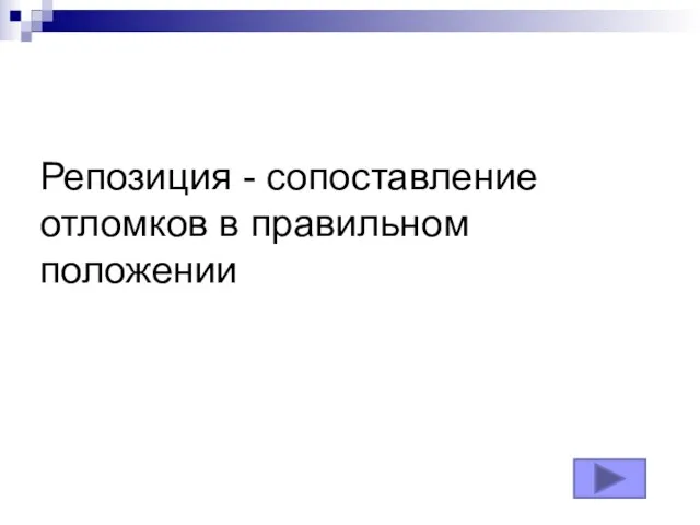 Репозиция - сопоставление отломков в правильном положении