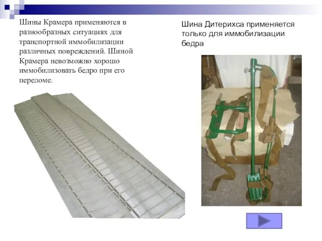 Шины Крамера применяются в разнообразных ситуациях для транспортной иммобилизации различных повреждений.