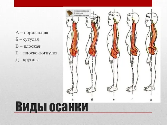 Виды осанки А – нормальная Б – сутулая В – плоская