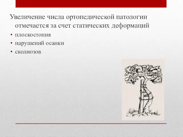 Увеличение числа ортопедической патологии отмечается за счет статических деформаций плоскостопия нарушений осанки сколиозов