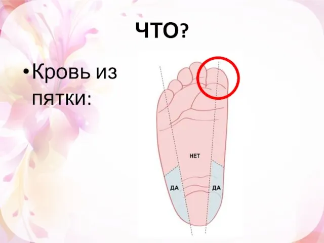 ЧТО? Кровь из пятки: