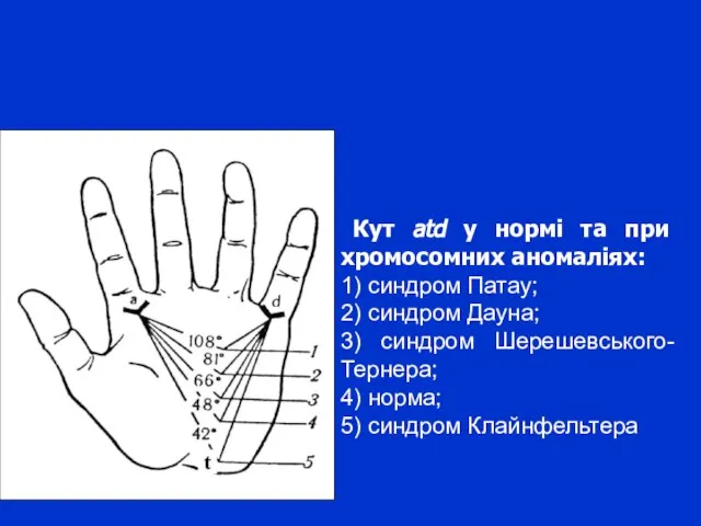 Кут atd у нормі та при хромосомних аномаліях: 1) синдром Патау;