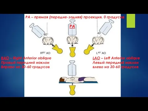 RAO – Right Anterior oblique Правый передний наклон Вправо на 30-60