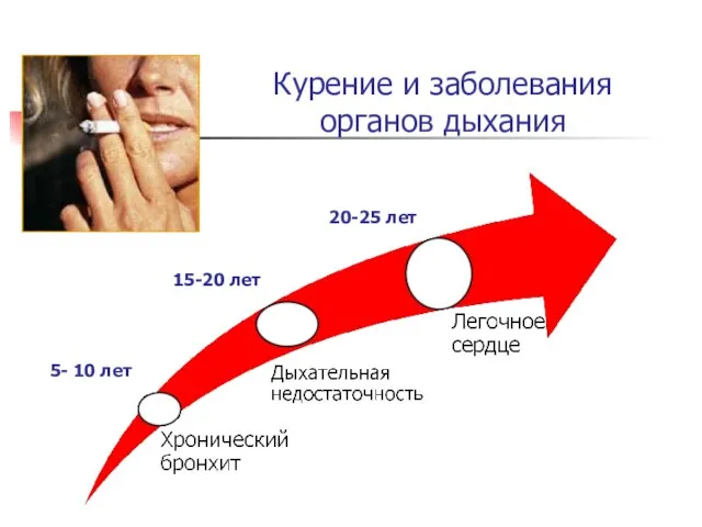 Курение и заболевания органов дыхания 5- 10 лет 15-20 лет 20-25 лет