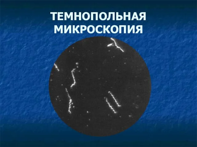 ТЕМНОПОЛЬНАЯ МИКРОСКОПИЯ