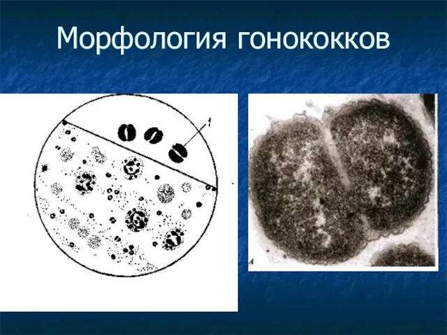 Морфология гонококков