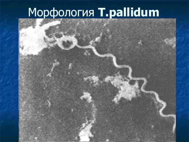 Морфология T.pallidum