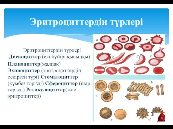 Эритроциттердің түрлері Дискоциттер (екі бүйірі қысыңқы) Планоциттер(жалпақ) Эхиноциттер (эритроциттердің ескірген түрі)