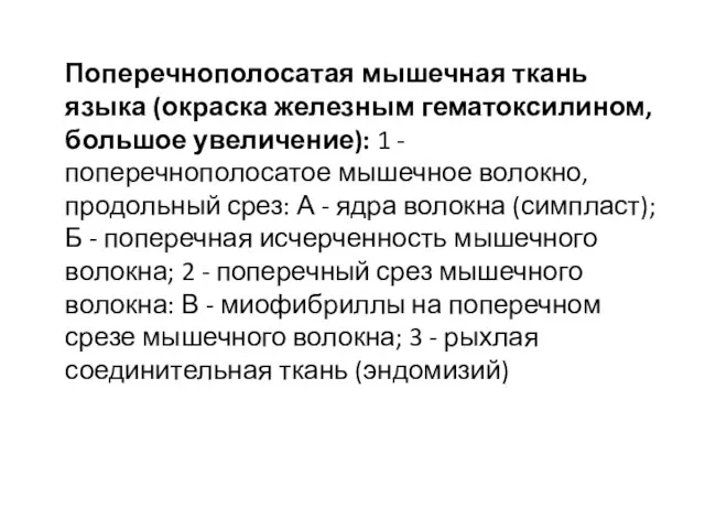 Поперечнополосатая мышечная ткань языка (окраска железным гематоксилином, большое увеличение): 1 -